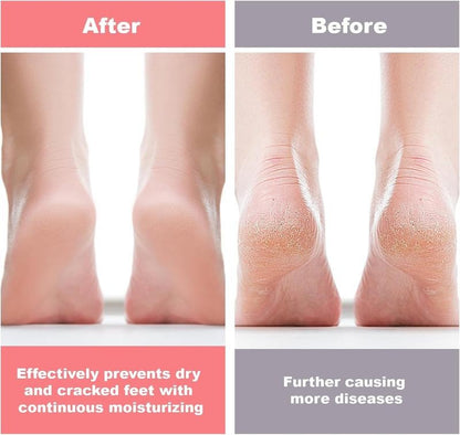 Silicone Moisturizing Socks for Cracked.